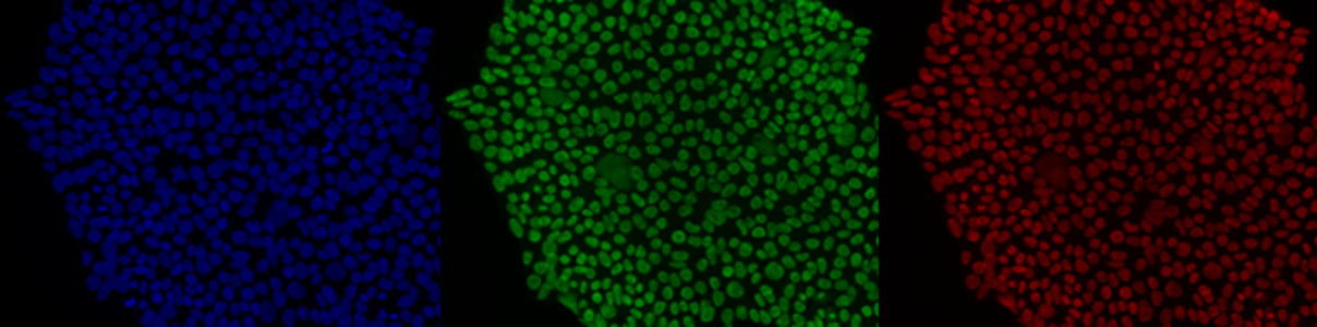 ERIBA-Image-iPS-cells-color-2